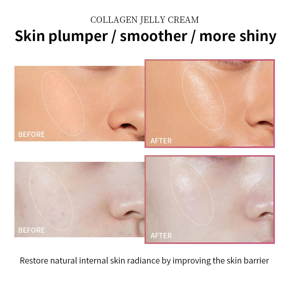 Moisturizing Collagen Jelly Cream – Anti-Aging & Firming