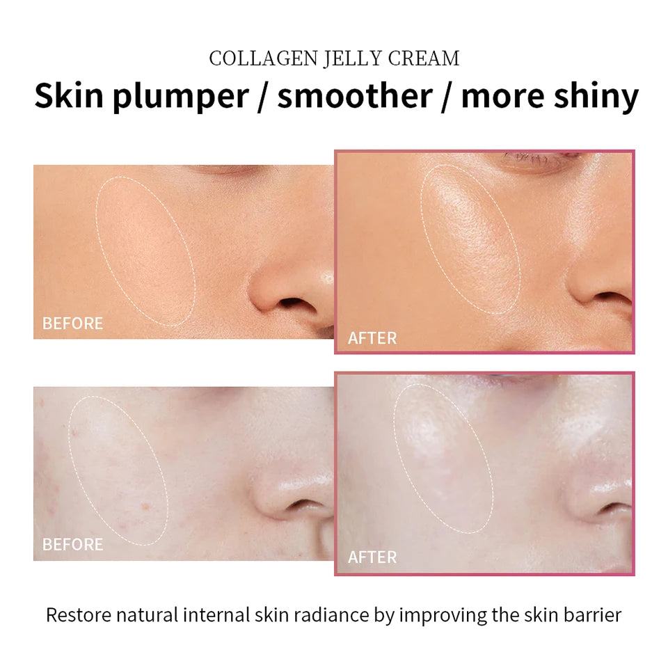 Moisturizing Collagen Jelly Cream – Anti-Aging & Firming
